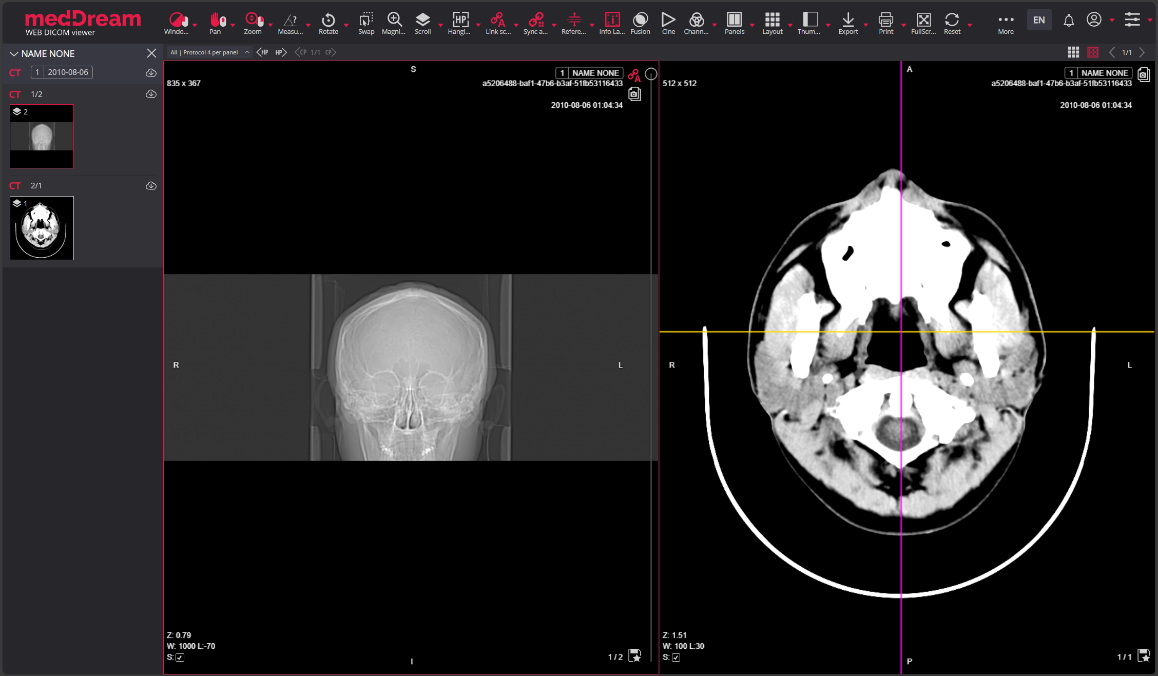 MedDream DICOM Viewer